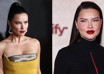 Estetik yaptırdığını söyleyenlere ateş püskürdü: Bu yalnızca yorgun bir annenin yüzü!