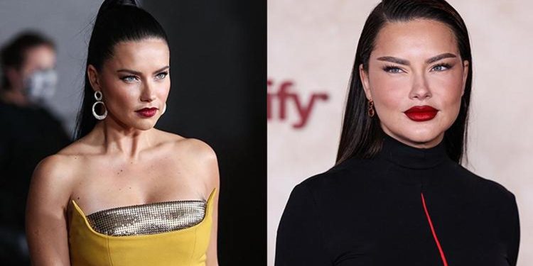 Estetik yaptırdığını söyleyenlere ateş püskürdü: Bu yalnızca yorgun bir annenin yüzü!