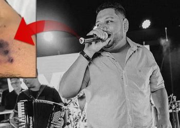 Hayranları ve sevenleri şoke oldu! Örümcek ısırığı müzikçi Darlyn Morais’in sonu oldu