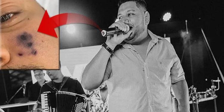 Hayranları ve sevenleri şoke oldu! Örümcek ısırığı müzikçi Darlyn Morais’in sonu oldu