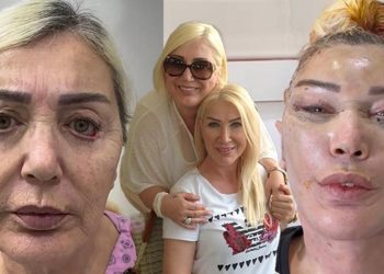 Seda Sayan’ın ablası estetik operasyonu geçirdi… Son hali şaşırttı!