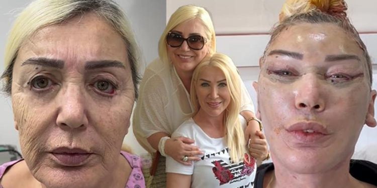 Seda Sayan’ın ablası estetik operasyonu geçirdi… Son hali şaşırttı!