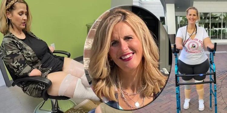 Tabipler grip dedi, 24 saat sonra komaya girdi: ‘Kol ve bacaklarım olmadan uyandım’