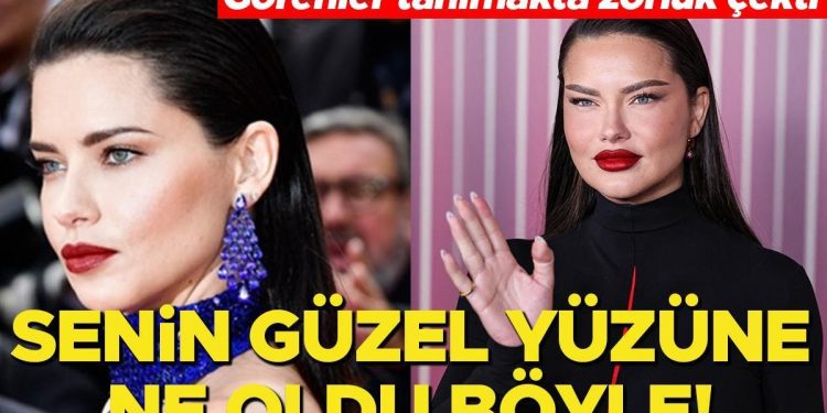 Ünlü modeli gören tanımakta zorlandı… ‘Senin hoş yüzüne ne oldu böyle!’