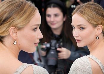 Ünlü yıldız estetik argümanlarını reddetti… ‘Benim bıçak altına yatmaktan ödüm kopar!’