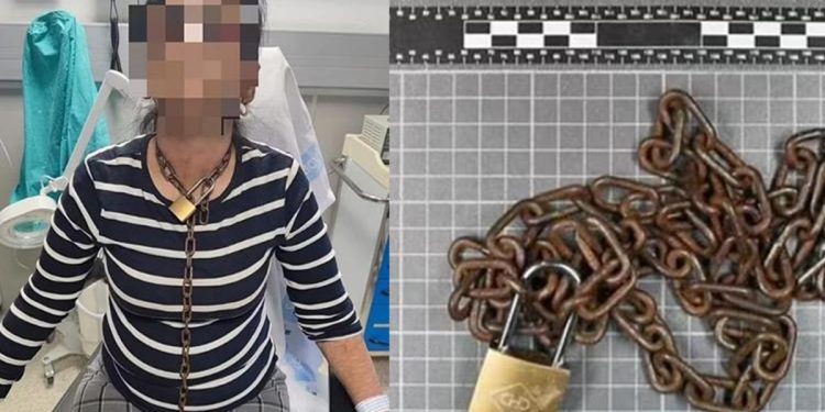 Boynunda ve ellerindeki zincirlerle hastaneye koştu! Dehşet veren olay…