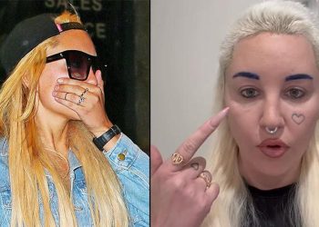 Şöhret ağır geldi… Bir vakitlerin yıldız oyuncusu akıl hastanesine bile yatmıştı: Estetik olup kendini baştan yarattı