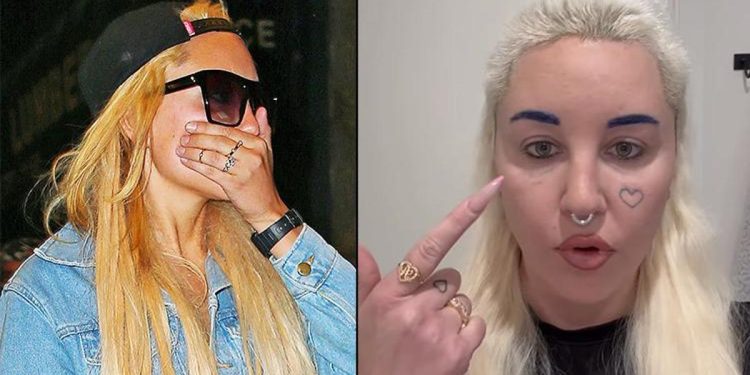 Şöhret ağır geldi… Bir vakitlerin yıldız oyuncusu akıl hastanesine bile yatmıştı: Estetik olup kendini baştan yarattı