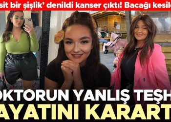 Yanlış teşhis yüzünden hayatı karardı! Hekimlerin ‘hizmetçi’ dizi dediği hastalık kanser çıktı… Genç bayanın bacağı kesildi