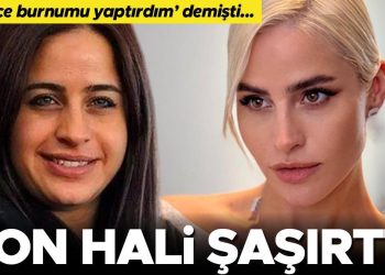 ‘Sadece burnumu yaptırdım’ demişti, son hali şaşırttı: Ne kadar hoşsunuz, hekiminiz kim?