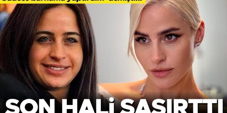 ‘Sadece burnumu yaptırdım’ demişti, son hali şaşırttı: Ne kadar hoşsunuz, hekiminiz kim?