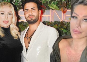 Seda Sayan’dan estetik açıklaması