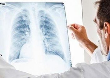 Zatürre belirtileri neler, nasıl bulaşır, hastalıktan nasıl korunabiliriz?