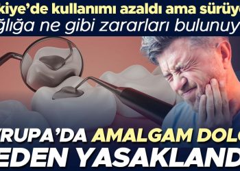 Avrupa’da Amalgam dolgu neden yasaklandı? Türkiye’de kullanımı azaldı lakin sürüyor… Sıhhate ne üzere ziyanları bulunuyor?