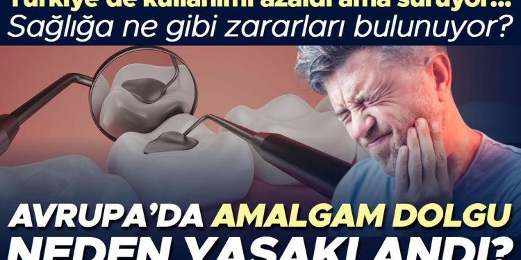 Avrupa’da Amalgam dolgu neden yasaklandı? Türkiye’de kullanımı azaldı lakin sürüyor… Sıhhate ne üzere ziyanları bulunuyor?