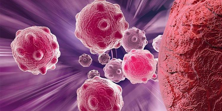 DSÖ 2050’ye kadar 35 milyondan fazla yeni kanser hadisesi öngörüyor: Eşit uğraş için ‘acil yatırım’ daveti