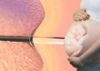 Embriyolar çocuk sayıldı, ABD’de  tüp bebek çalışmaları durdu