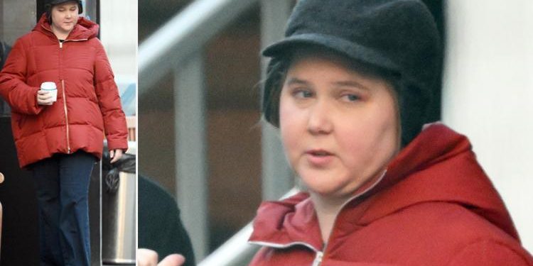 Herkes ünlü yıldızın yüzüyle alay etmişti: Altından önemli bir hastalık çıktı