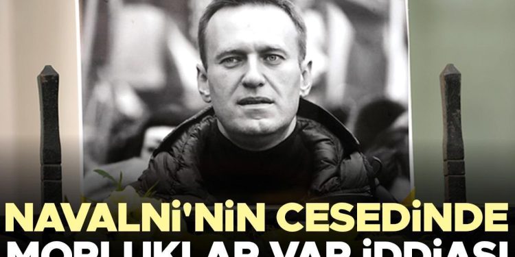 Navalni’nin cesedinde morluklar var savı