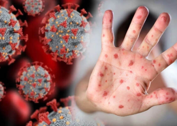 DSÖ’den kritik açıklama: Maymun çiçeği ve Kovid-19 bulaşma farkı…