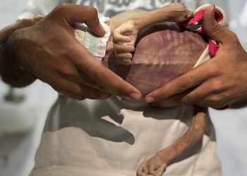 Gazze Şeridi’nde 127 kişi açlıktan hayatını kaybetti