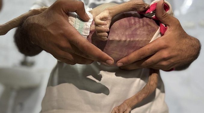 Gazze Şeridi’nde 127 kişi açlıktan hayatını kaybetti